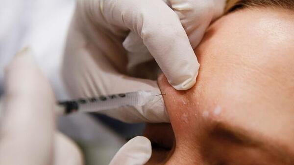 ¿Qué son los «faciales vampiro» y por qué hay tres casos de VIH vinculados a estos tratamientos en EE.UU.?