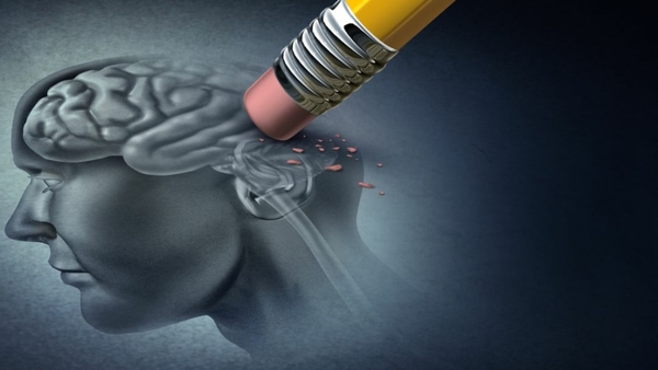 Alzheimer, enfermedad generada por hasta 20 años de daños en el cerebro