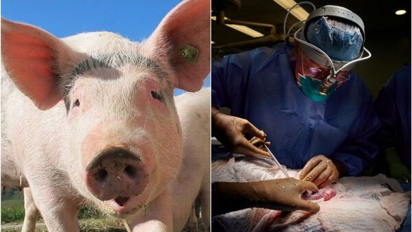Mujer de EE.UU., segunda persona en el mundo en recibir un riñón procedente de un cerdo