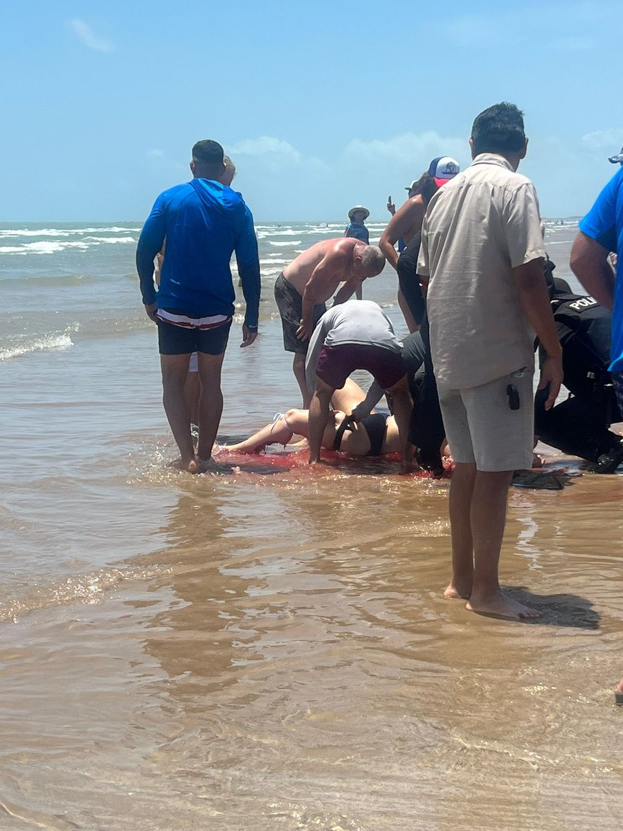 Tiburón hiere gravemente a bañista en la Isla del Padre, Texas
