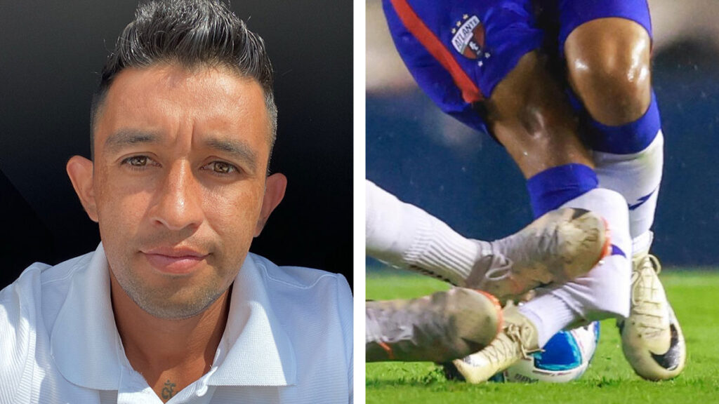 Le voy a echar todas las ganas: Hobbit Bermúdez