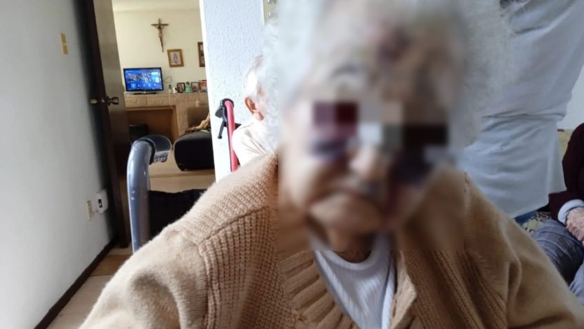 Denuncian golpes y malos tratos contra abuelitos en asilo de San Luis Potosí