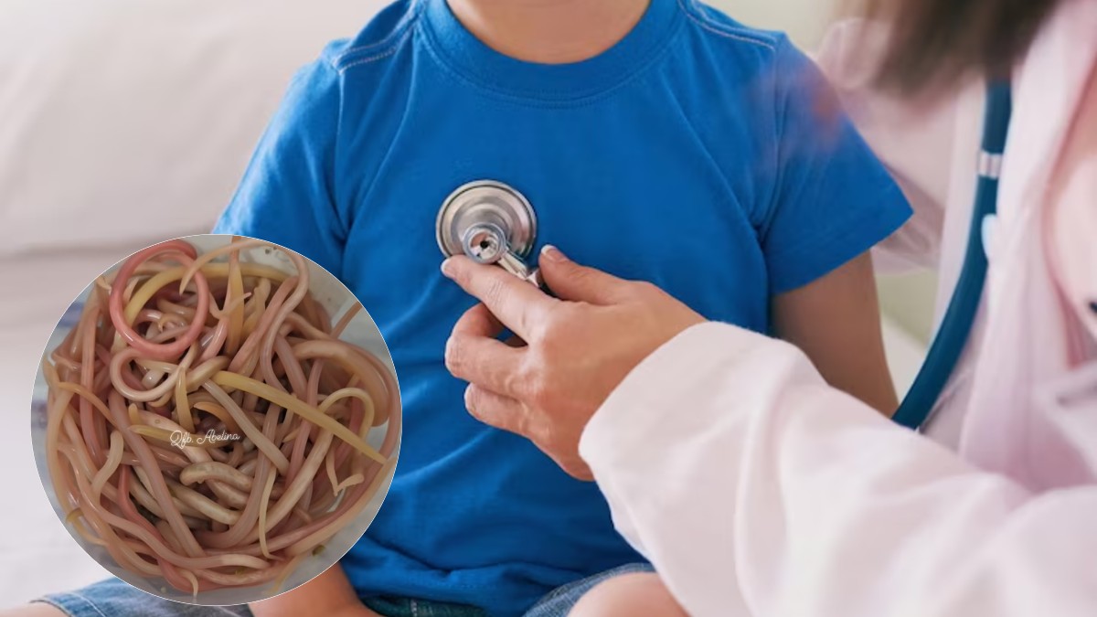 Extirpan 142 lombrices del intestino a niño en Chiapas tras sufrir obstrucción intestinal