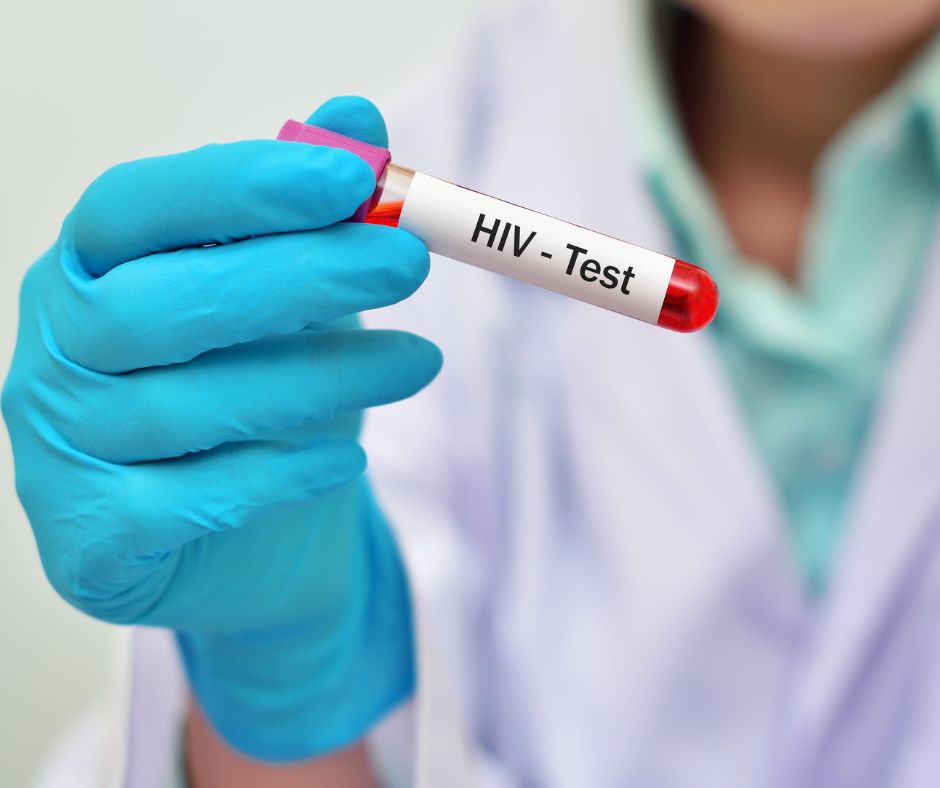 Chiapas, cuarto lugar nacional en nuevos casos de VIH en 2025