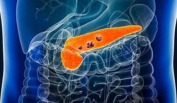 Cómo limpiar de forma natural el páncreas