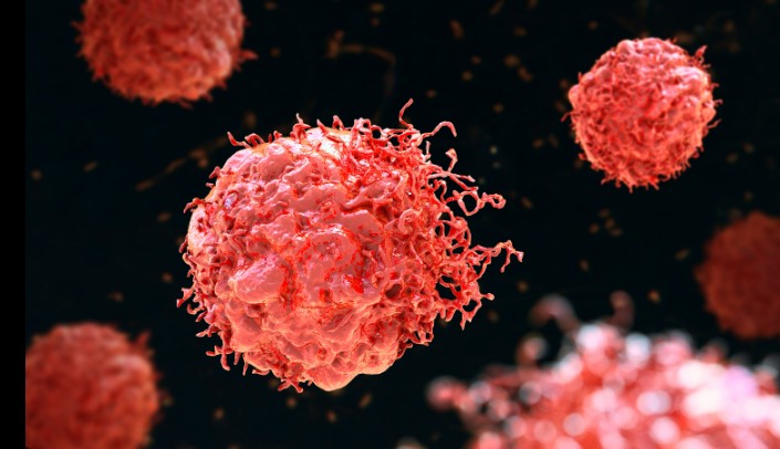 Encuentran la célula de origen del sarcoma de Ewing