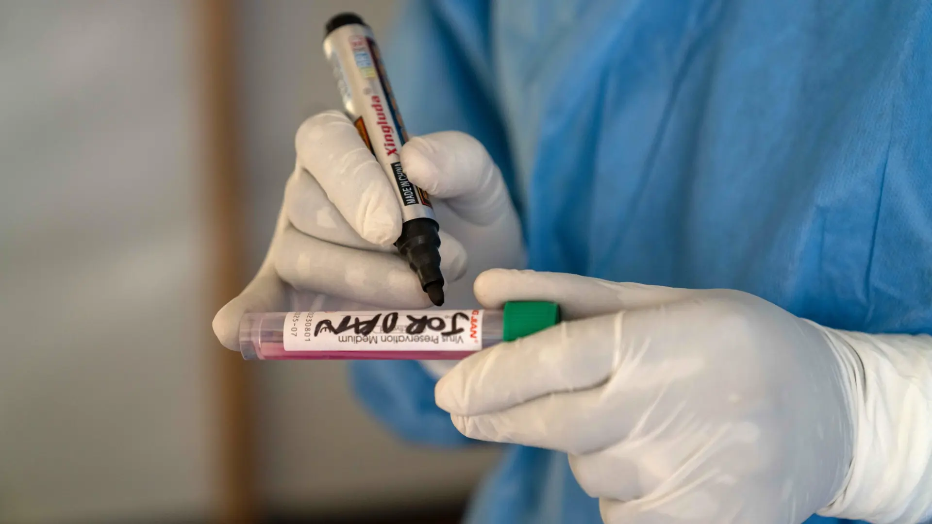 Identifican una nueva cepa de mpox, mejor conocida como ‘viruela del mono’